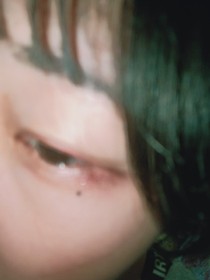 滴液