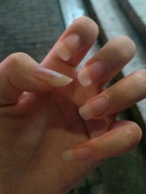 小宇
