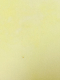 野鸡湖