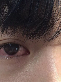 抑郁症患者的一生