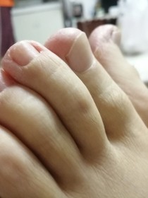 香肠快餐