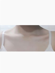 锁痣