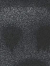 死盾