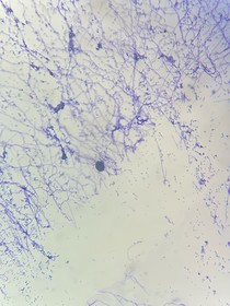 MCRS腐化共生part