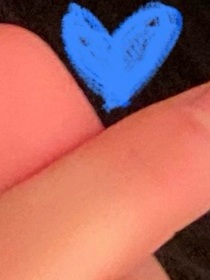 崔秀彬：不必要的故事