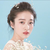张雪迎