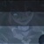 帕洛斯·黑
