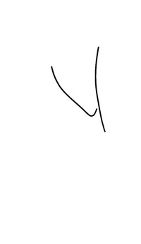 散集
