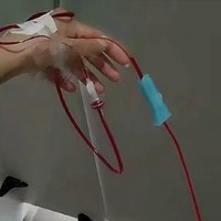 醋缸