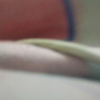 无穷追杀