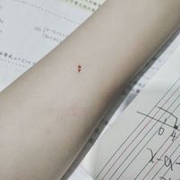生活疼痛