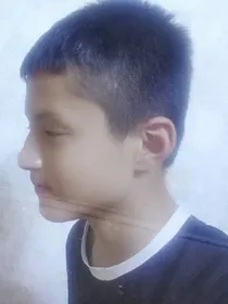 艾精彩的烦恼