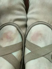 舞蹈生的辛苦