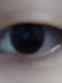 小恐