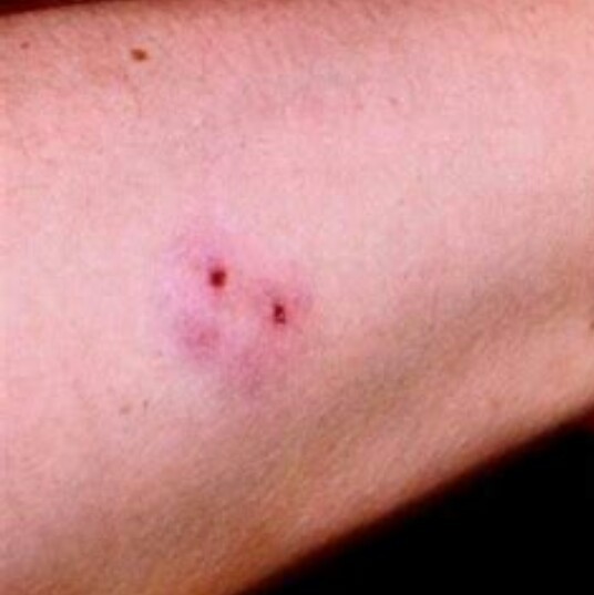 第十二章 蛇咬过的痕迹-决定追到你-话本小说网