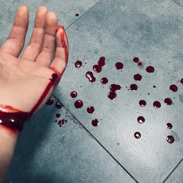 手腕割血图真实点的图片